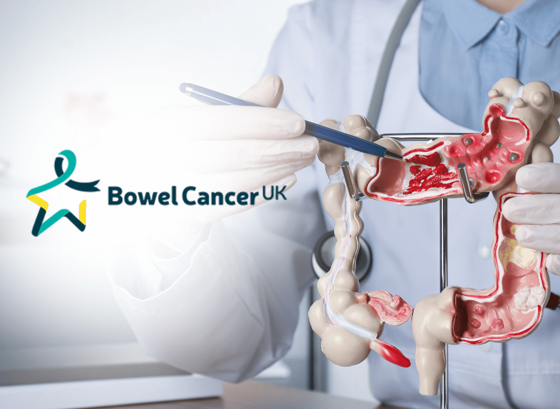 Bowel Cancer Awareness Month: Knowing the Signs and Getting Screened